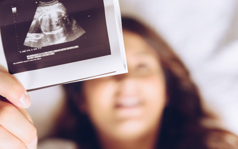 Woman with early ultrasound photo
